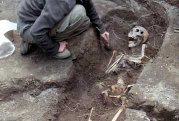 Η σύφιλη «υπήρχε στην Ευρώπη ακόμη και προτού ανακαλυφθεί η Αμερική»