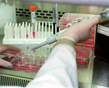 Εντοπίστηκε γονίδιο που επιβραδύνει τη διαδικασία της γήρανσης