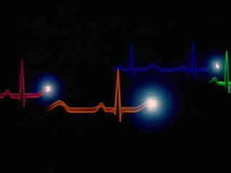 Και η ανέχεια παράγοντας εμφράγματος