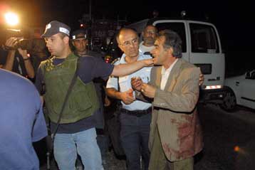 Ένας Παλαιστίνιος νεκρός και δύο τραυματίες από πυρά στη Δυτ.Όχθη