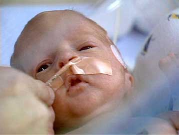 «Ένοχο» το Phenergan για το θάνατο βρεφών την ώρα του ύπνου, υποστηρίζει Αυστραλέζα ερευνήτρια