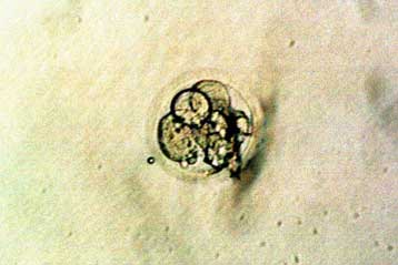 Η Αυστραλία αποφάσισε να απαγορεύσει τον αναπαραγωγικό κλωνισμό ανθρώπων