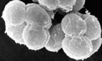 Αμφισβητείται η ηλικία του βακτηρίου – μαθουσάλα