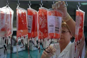 Γονιδιακή θεραπεία αναστρέφει προσωρινά τα συμπτώματα της αιμοφιλίας