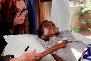 Πέθανε το «σύμβολο» του αγώνα κατά του AIDS, ο 12χρονος Νκόσι Τζόνσον