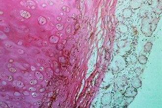 Οι ειδικοί προβλέπουν: Αυτοί θα είναι οι πιο θανάσιμοι καρκίνοι σε 20 χρόνια