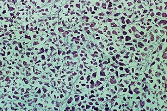 Το αίμα «φορέας» αντικαρκινικών φαρμάκων