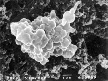 Ερευνητής υποστηρίζει ότι εντόπισε στην ατμόσφαιρα μικρόβια από το Διάστημα