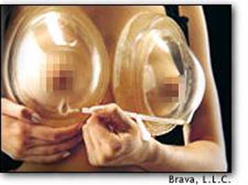 Στηθόδεσμος που δημιουργεί κενό αέρα αυξάνει αναίμακτα το στήθος