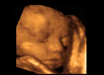 Τα μωρά θυμούνται για πολύ καιρό μελωδίες που άκουσαν προτού γεννηθούν