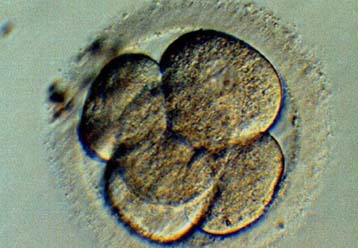 Τρόπο γονιμοποίησης ωαρίου χωρίς σπερματοζωάριο αναζητούν Αυστραλοί επιστήμονες