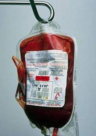 Δικαστήριο δικαιώνει συγενείς θύματος AIDS που είχε προσβληθεί από μετάγγιση