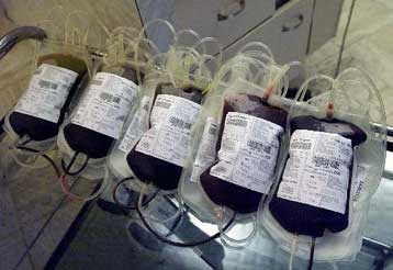 Οι ΗΠΑ απαγορεύουν την εισαγωγή και λήψη αίματος από όσους διέμεναν στην Ευρώπη