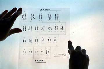 Ερευνητές εντοπίζουν χρωμοσωμική περιοχή που σχετίζεται με υψηλό προσδόκιμο ζωής