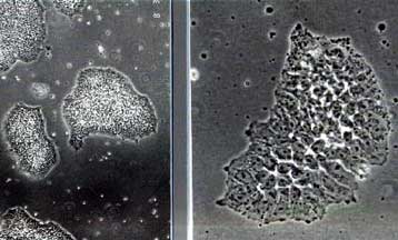 Η κυβέρνηση των ΗΠΑ διαπραγματεύεται τους όρους για τη διάθεση εμβρυϊκών κυττάρων σε κρατικά ιδρύμα