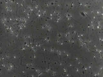 Τα φυτοφάρμακα ενοχοποιούνται για την πρόκληση ανδρικής στειρότητας