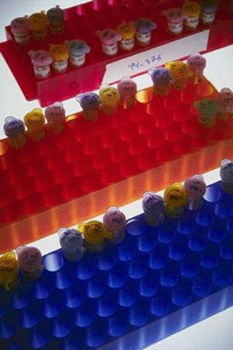 Γενετικός κρίκος μεταξύ καρκίνου του μαστού και του εντέρου