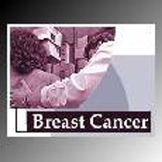 Η φυσική άσκηση μειώνει τον κίνδυνο καρκίνου του μαστού