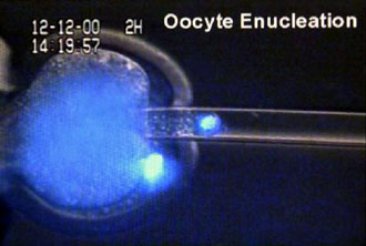 Οι γραφειοκρατικές διαδικασίες εμποδίζουν τις έρευνες με βλαστικά κύτταρα