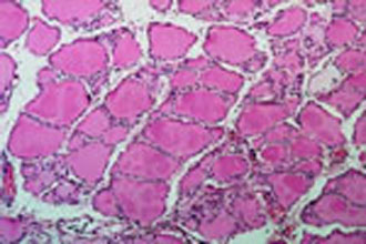 Ποιοι θα χρηματοδοτηθούν από τις ΗΠΑ για πειράματα με βλαστικά κύτταρα