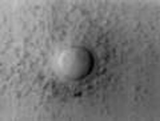 Προς γονιδιακό τεστ που θα προβλέπει την πρόωρη εμμηνόπαυση