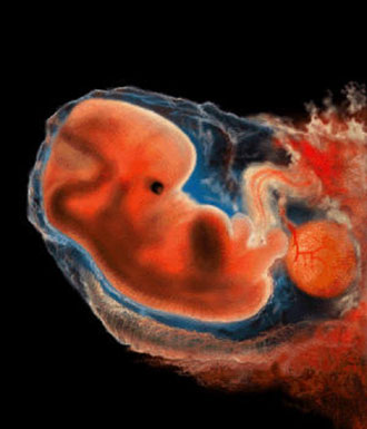 Η νοημοσύνη συνδέεται με το βάρος γέννησης