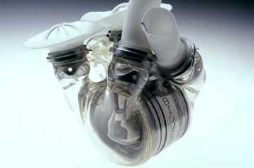 Επιτυχής και η δεύτερη μεταμόσχευση τεχνητής καρδιάς