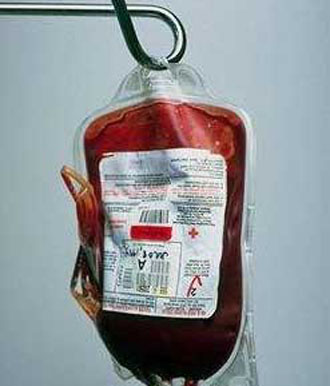 Υπερψηφίστηκαν οι προτάσεις Τρακατέλλη για τη δημιουργία «κοινής αγοράς αίματος» στην ΕΕ