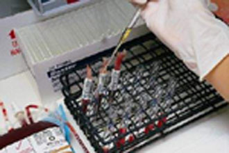 Δωρεάν νοσοκομειακή περίθαλψη σε αλλοδαπούς μετανάστες που έχουν μολυνθεί από τον ιό του AIDS