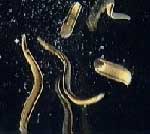 Ανακαλύπτοντας το παρελθόν: Βδέλλες για την αντιμετώπιση της οστεοαρθρίτιδας