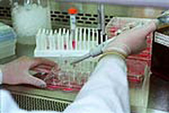 Ένα βήμα μπροστά στην κατανόηση των πολυγονιδιακών νόσων