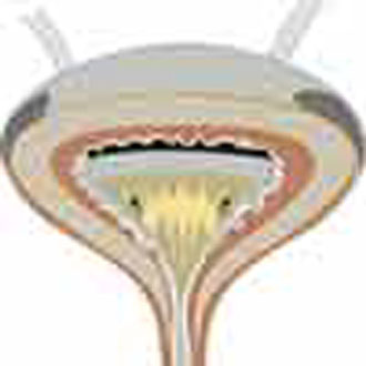 Το κάπνισμα ενοχοποιείται και για τον καρκίνο της ουροδόχου κύστης