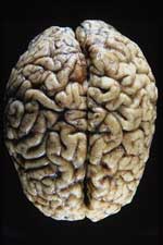 Πώς σχετίζονται οι νόσοι Alzheimer και Parkinson;