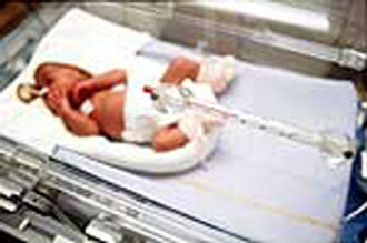 Κίνδυνος άσθματος για τα λιποβαρή βρέφη