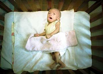 Ορατός κίνδυνος επιδημίας AIDS στην Ασία