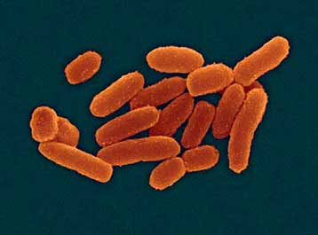 Δημοσιεύθηκε ο γενετικός χάρτης του βακτηρίου της πανώλης