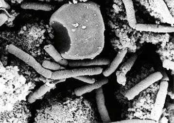 Σημαντικές εξελίξεις στην κατανόηση της νόσου του άνθρακα