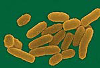 Το γονιδίωμα του Μαύρου Θανάτου: Δημοσιεύθηκε ο γενετικός χάρτης του βακτηρίου της πανώλης