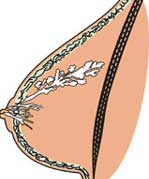 Η βιταμίνη D προφυλάσσει από τον καρκίνο του μαστού