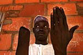 Αποκαλύπτονται τα αίτια του πόνου στο «μέλος-φάντασμα» έπειτα από ακρωτηριασμό