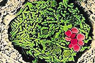 Σημαντικές εξελίξεις στην κατανόηση της νόσου του άνθρακα