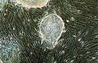 Παραγωγή βλαστικών κυττάρων με… «παρθενογένεση»