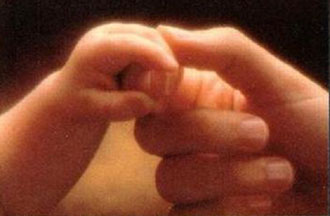 Η βουβωνοκήλη στα παιδιά