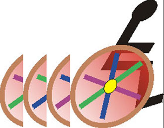 Έκθεση ζωγραφικής του Πανελλήνιου Συλλόγου Παραπληγικών