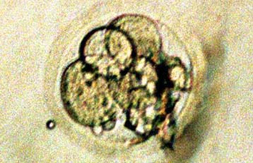 Το πρώτο κλωνοποιημένο ανθρώπινο έμβρυο αναπαρήγαγε αμερικανική εταιρεία