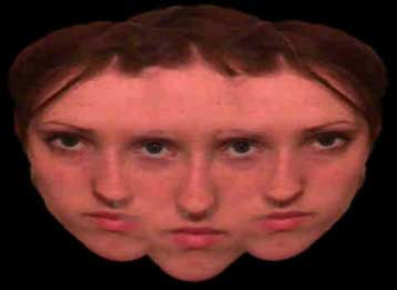 Η σχιζοφρένεια σχετίζεται στατιστικώς με σεξουαλικώς μεταδιδόμενα νοσήματα