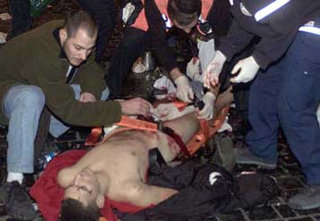 Νέα έκρηξη σε λεωφορείο στο Ισραήλ προκαλεί το θάνατο 14 ανθρώπων