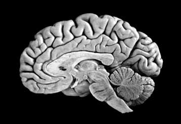 Επώδυνα ερεθίσματα ενεργοποιούν στον εγκέφαλο… τα κέντρα επιβράβευσης