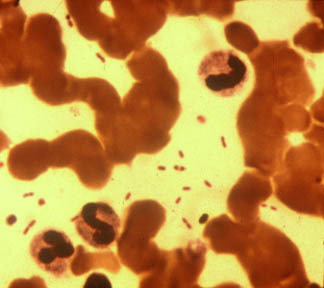 Φαντάσματα από το παρελθόν: Κρούσματα πανώλης σε ινδικό κρατίδιο