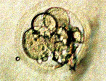 Πρόωρος θάνατος η πιθανή «παρενέργεια» του κλωνισμού θηλαστικών